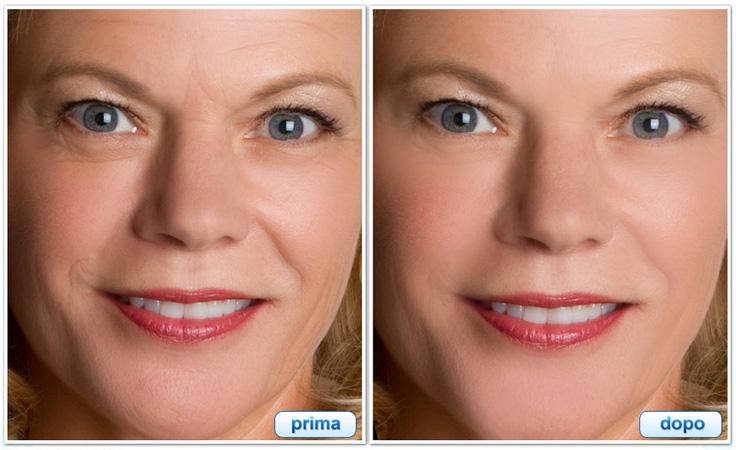 Crema-Fast Lifting