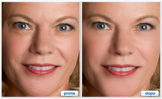 Crema-Fast Lifting